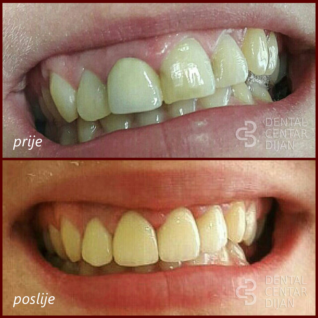 Estetska dentalna medicina
