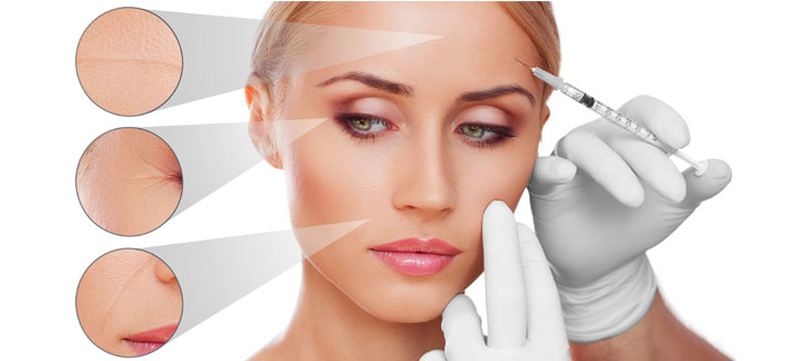 Dermal fillers